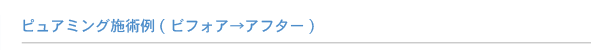 ピュアミング施術例